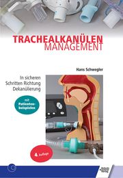 Trachealkanülenmanagement Schwegler, Hans 9783824812608